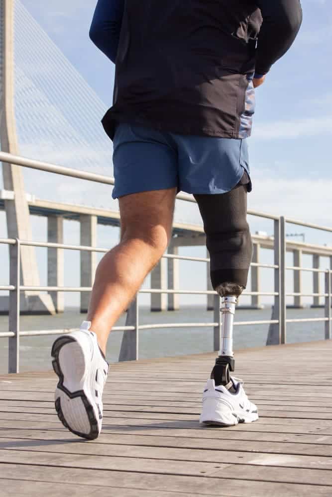 a man running with a prosthesis