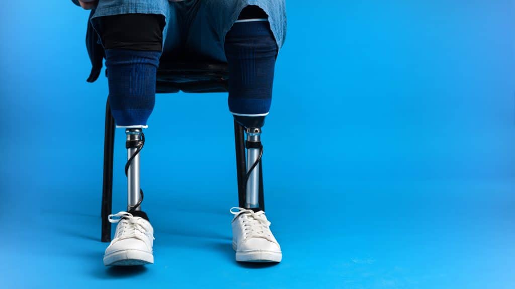 man with prosthetic legs